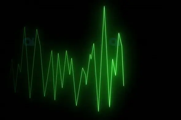 Green Audio Waveform Visualization Effect